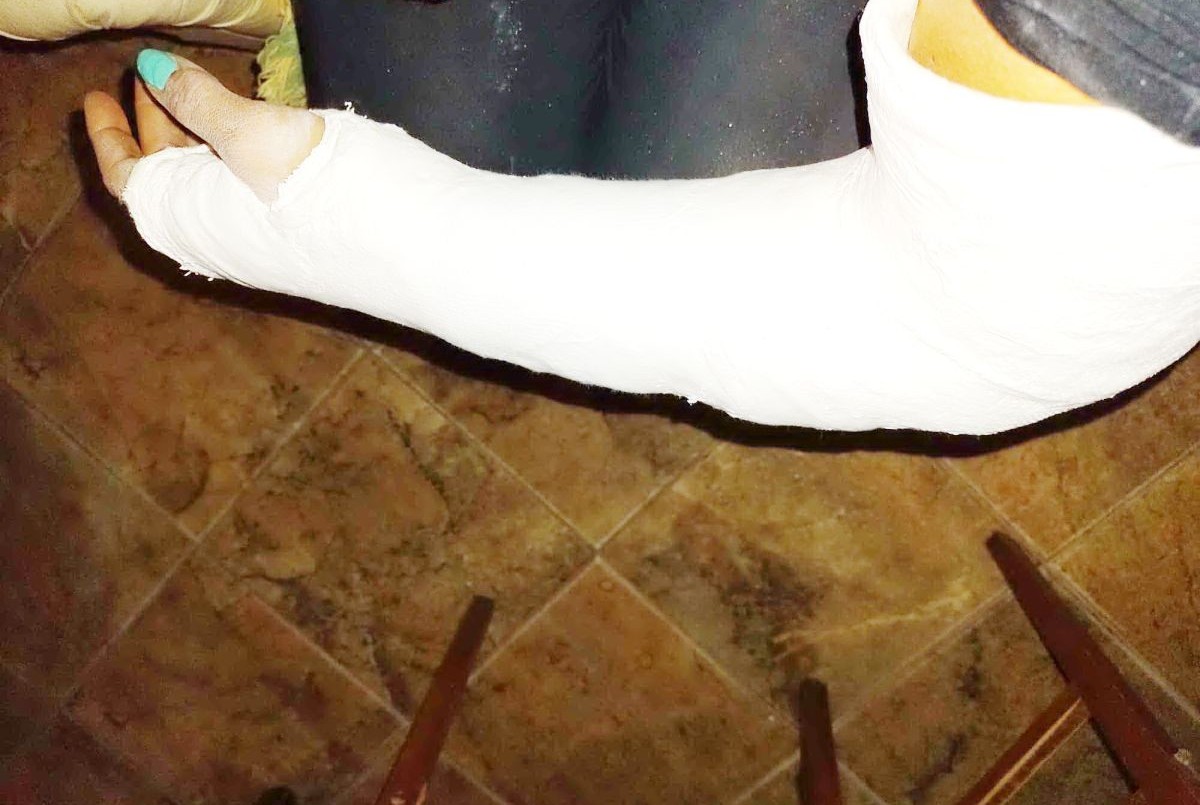 Un grupo de perros atacó a una motociclista y terminó con una fractura | Información General