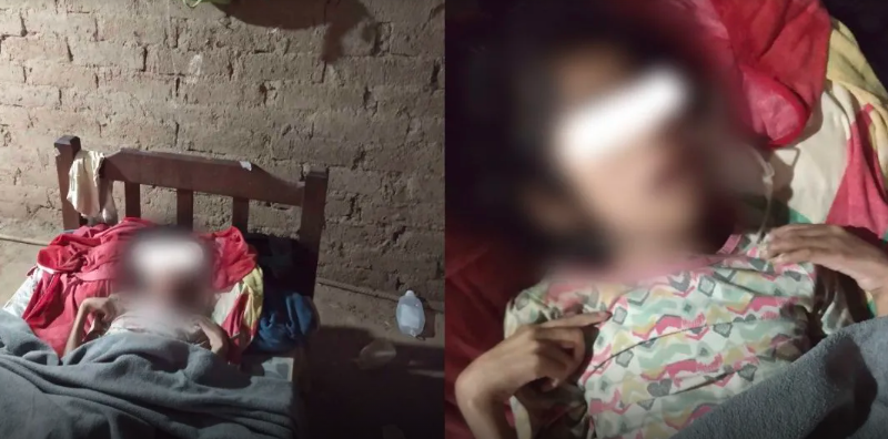 El calvario de una nena que quedó huérfana: no come y los chanchos le comieron los dedos | Información General