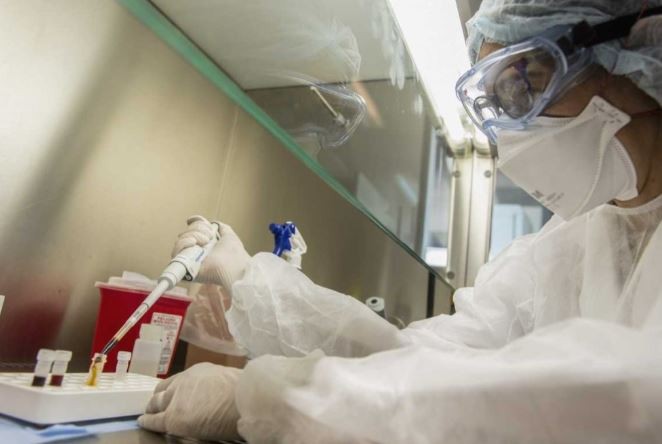 Viruela del mono: afirman que hay "altas probabilidades" de que el caso sospechoso en la Argentina sea positivo | Información General