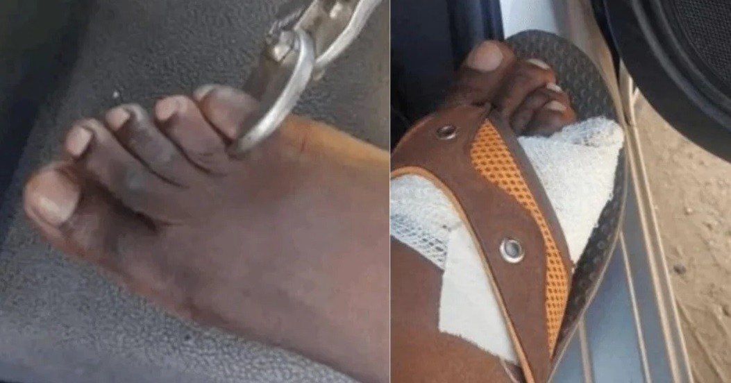 Aseguran que venden los dedos del pie por hasta US$ 40.000 | Internacionales