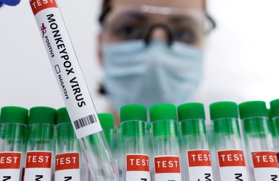 Confirmaron el quinto caso de viruela del mono en la Argentina | Información General
