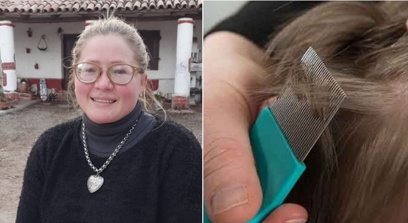 Trabaja medio día y para completar sus ingresos se ofrece como "sacadora de piojos" | Información General