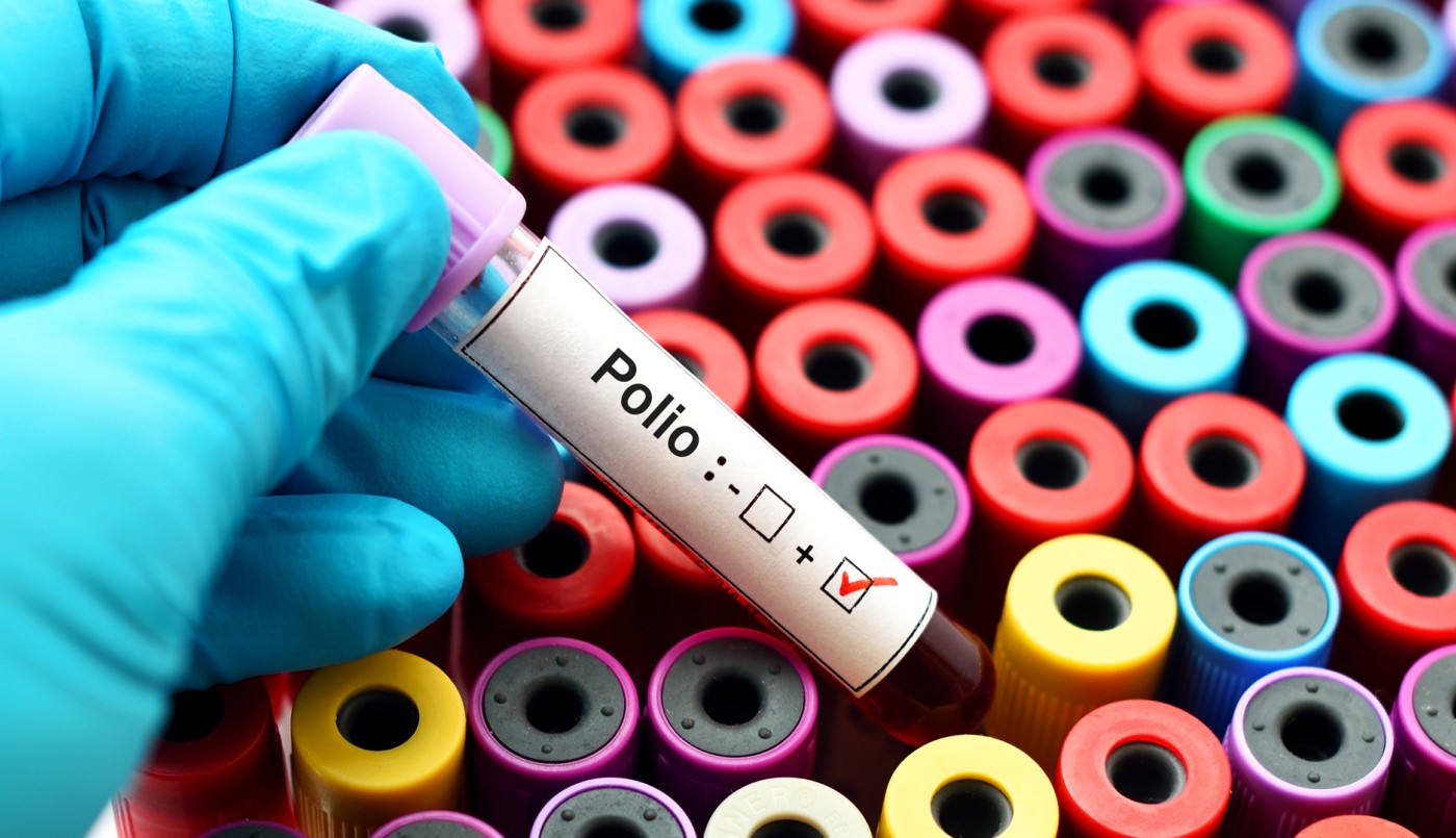 Nueva York detectó el virus de la poliomielitis en aguas residuales de la ciudad y advierten que podría haber circulación comunitaria | Internacionales
