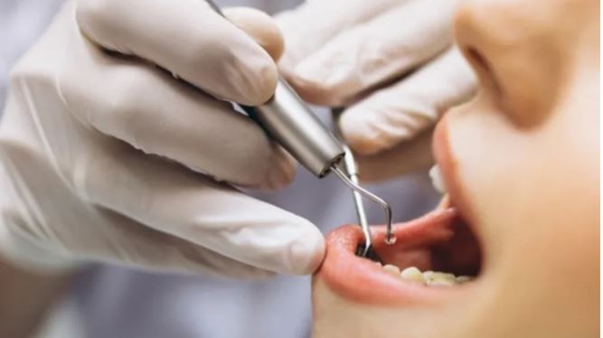 Los dientes y prótesis en mal estado aumentan el riesgo de cáncer bucal | Tecnología