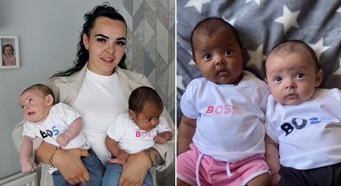 "Me preguntan si ambos son míos": dio a luz gemelos con distinto color de piel | Internacionales