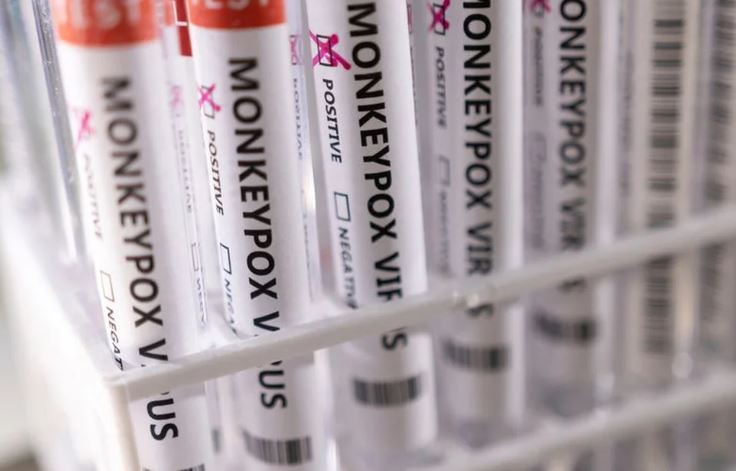 Viruela del mono: la OMS informó que ya son más de 50.000 los casos en el mundo | Internacionales