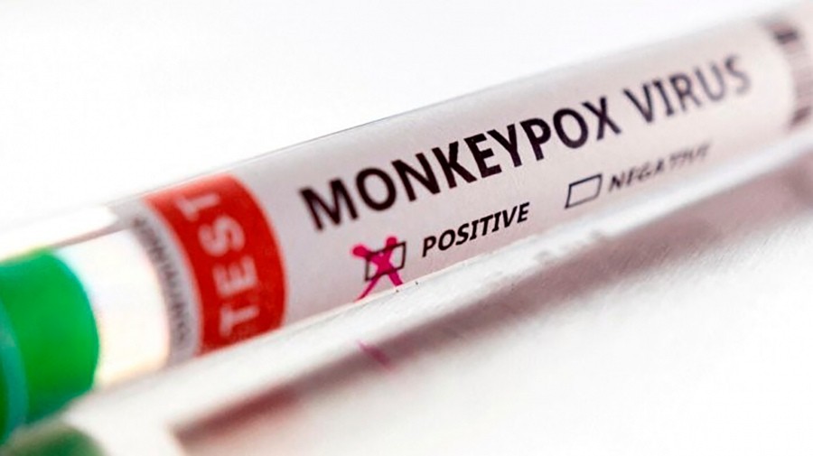 Viruela del mono en Argentina: confirmaron otros 265 casos, un 20% más que la semana anterior | Información General