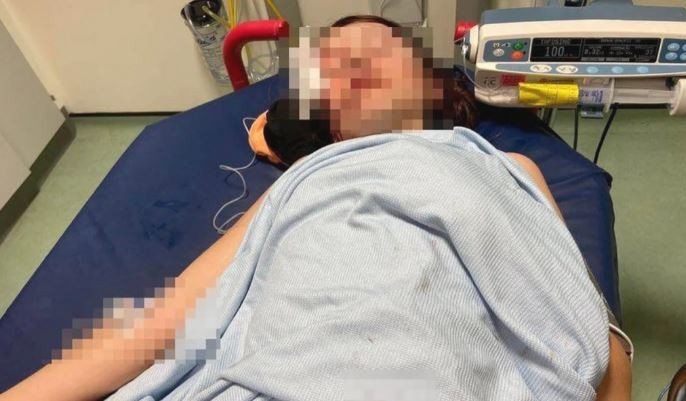 Escocia: golpearon a una nena con autismo hasta dejarla inconsciente | Internacionales