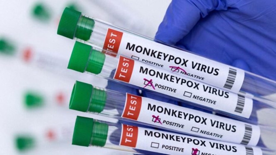 Viruela del mono: confirman el primer caso infantil y la primera internación en terapia intensiva | Información General