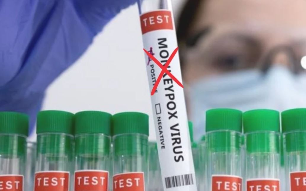 Cambiaron el nombre a la viruela del mono por considerarlo un "lenguaje racista y estigmatizante" | Información General