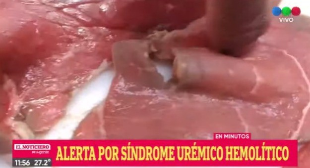 Alertan por dos casos de Síndrome Urémico Hemolítico en Rosario | Rosario y la región