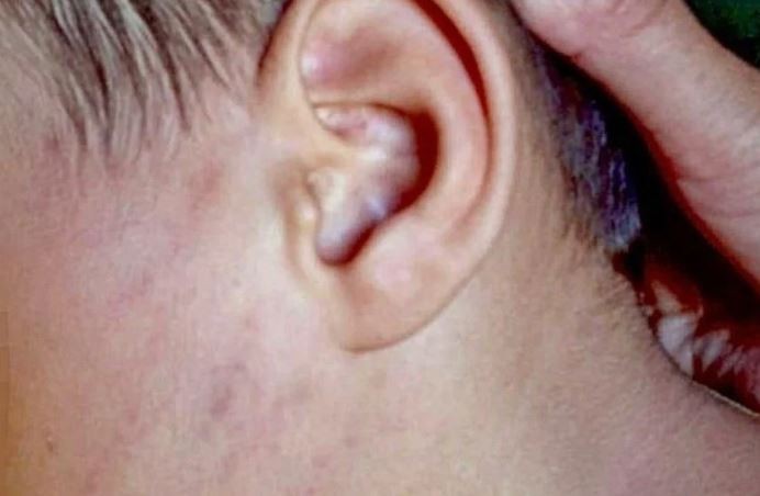 Denuncian a padres por "lesiones graves" a su hijo de 4 años en Santiago del Estero | Información General