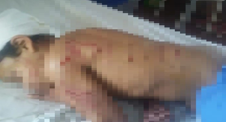 "Pensé que lo mataban": una jauría atacó a un nene de 9 años | Información General