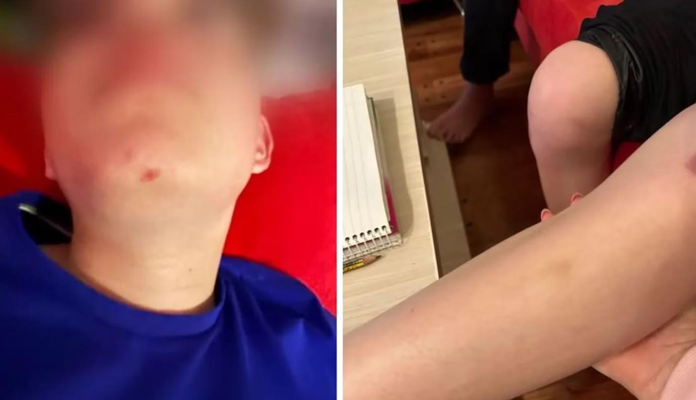 Nene de 10 años entró por error en la cancha de golf de un country y una pareja lo atacó a pelotazos | Información General