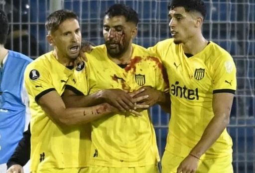 Escándalo: Un jugador de Peñarol recibió un corte tras ser agredido por un hincha de Rosario Central | Deportes