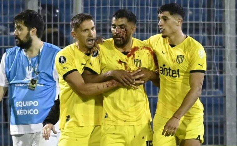 Detuvieron al plateísta de Central que le tiró el piedrazo a Olivera | Información General