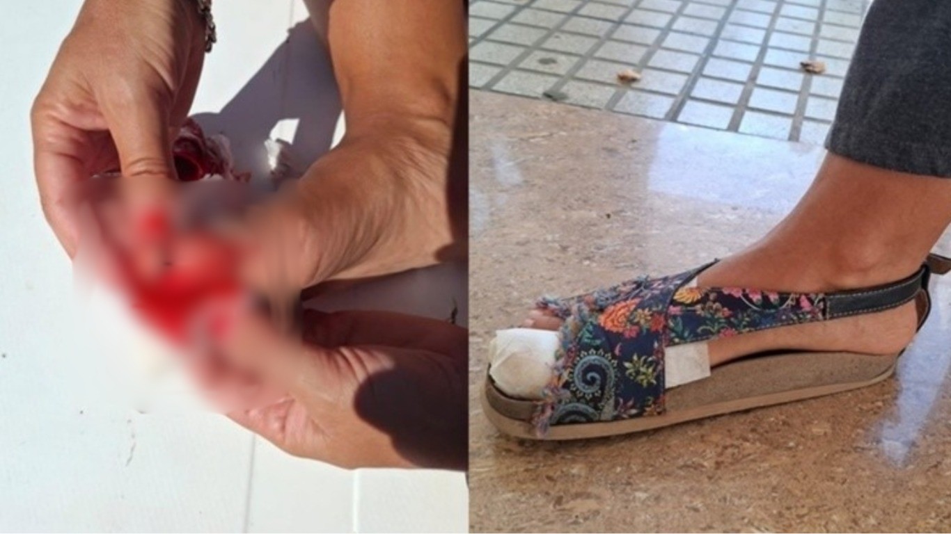 Una rosarina fue atacada por una palometa en el Paraná y alertó a los bañistas | Rosario y la región