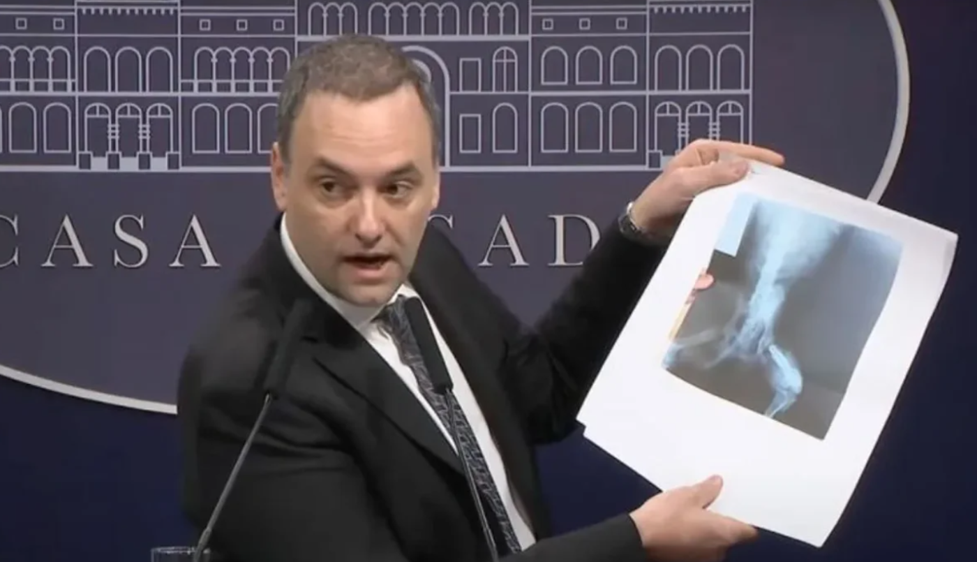 Por irregularidades, el Gobierno comienza a auditar más de un millón de pensiones de Anses por invalidez | Información General