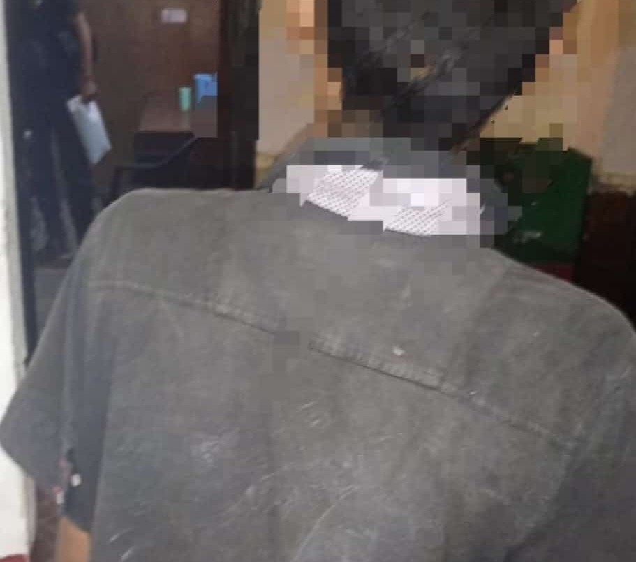 Mordió a un policía cuando intentaba huir tras cometer un robo | Información General