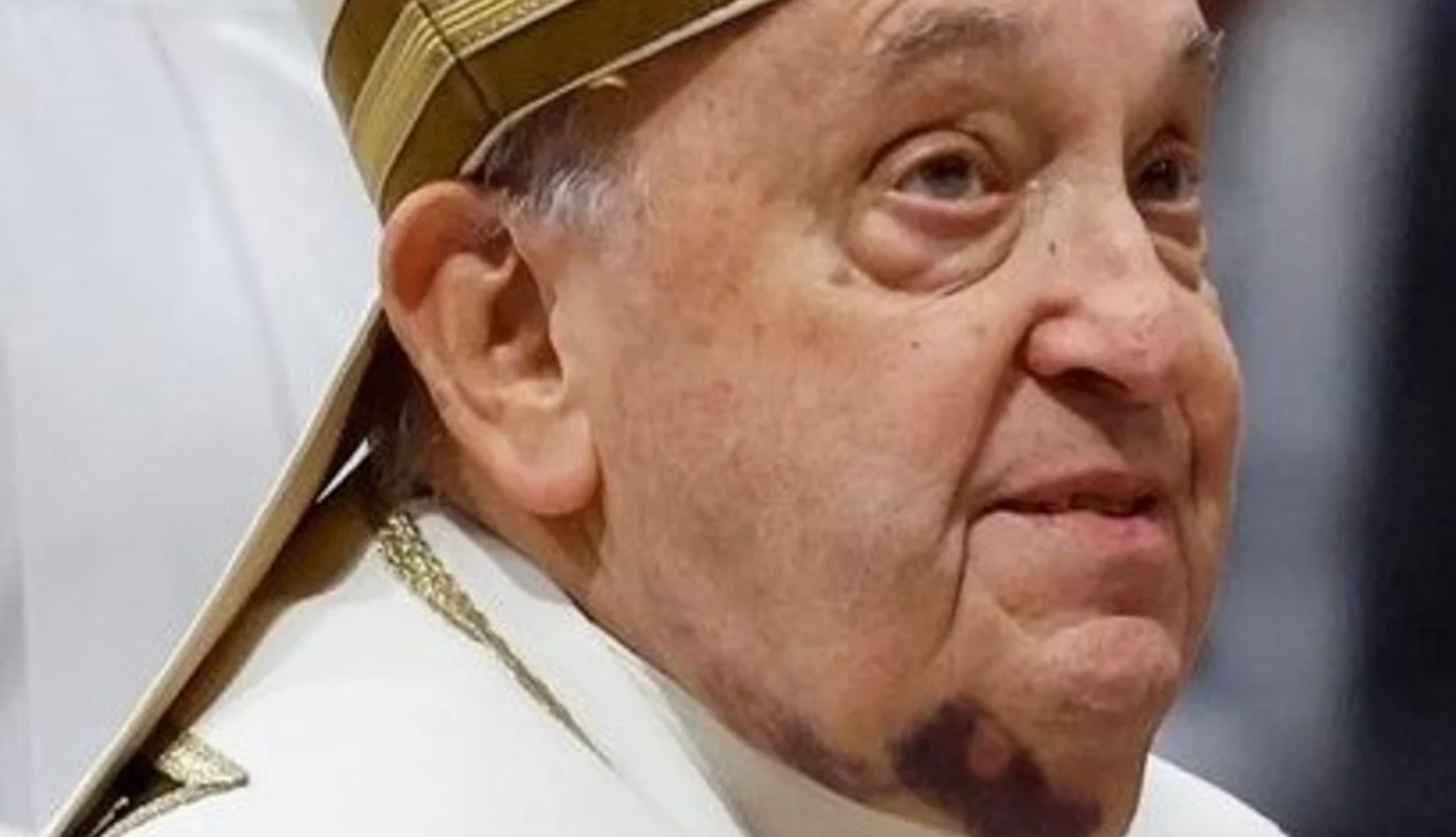 El Papa Francisco permanece en estado crítico y preocupa su insuficiencia renal | Internacionales