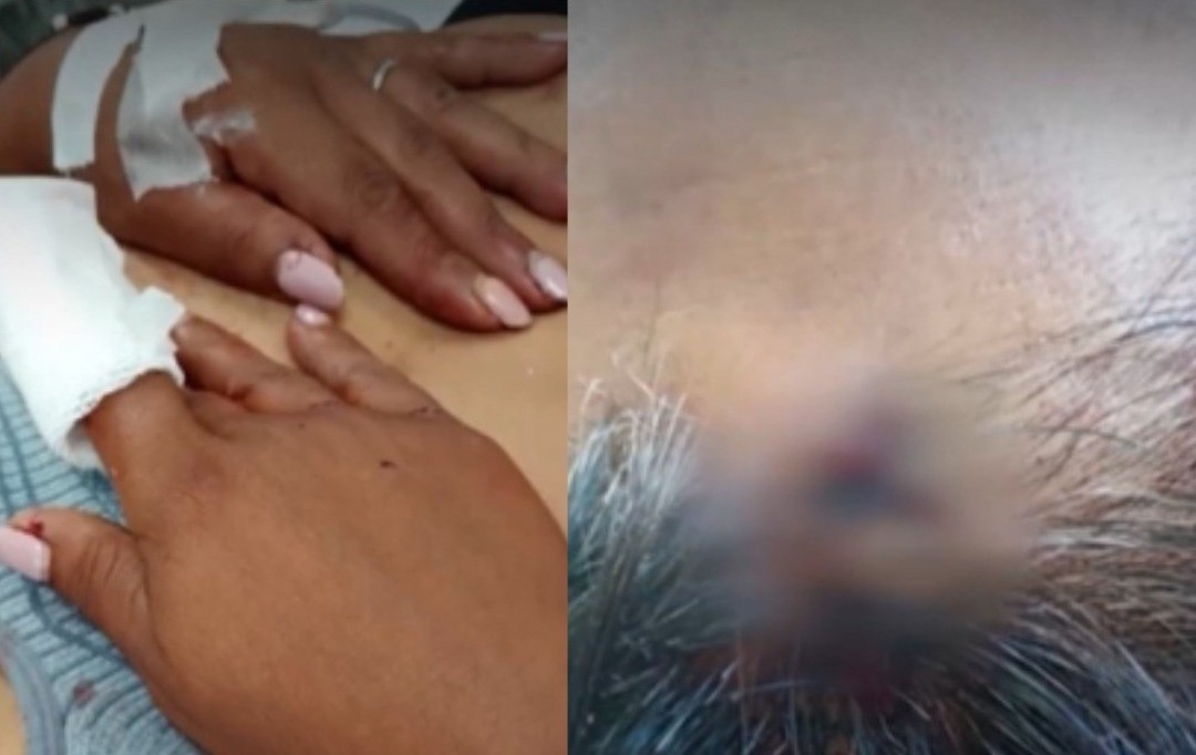 Torturaron a una mujer y le arrancaron el dedo para robarle | Rosario y la región