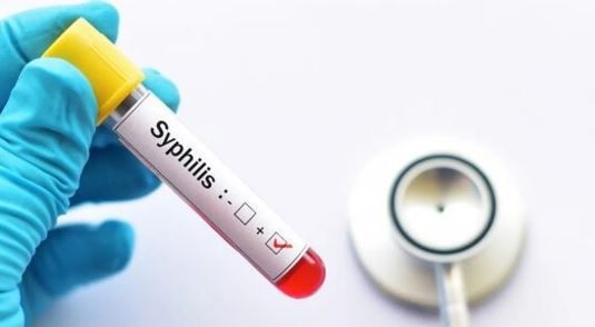 Preocupa el avance de la sífilis: se triplicaron los casos en adolescentes y recién nacidos | Información General