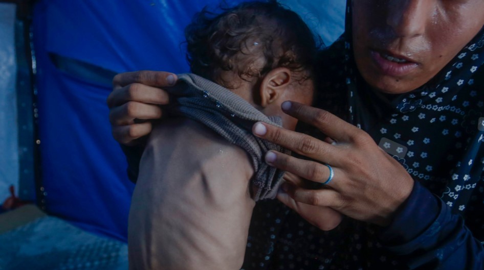 Ya son 227 los muertos relacionados con la desnutrición en Gaza, afirmó la ONU | Internacionales