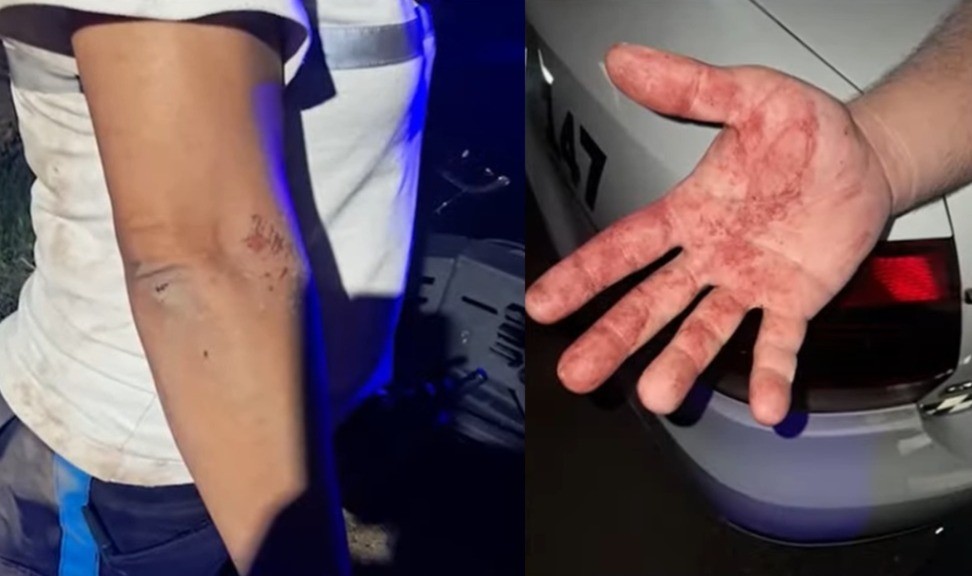 Agredieron a inspectores municipales tras intervenir en una fiesta por ruidos molestos | Rosario y la región