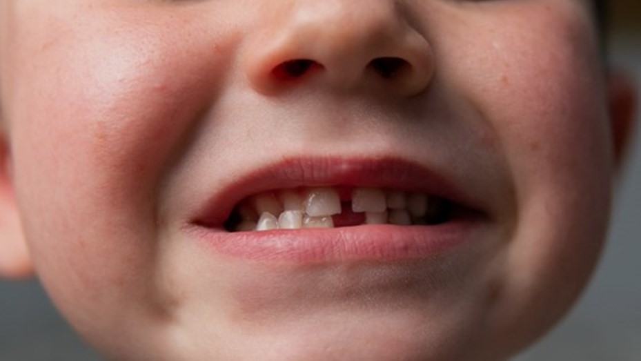 Madre condenada a 7 años por darle cocaína a su hijo de 4 años para calmarle el dolor de muelas | Información General