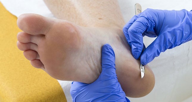 Cuando los pies hablan de nuestra salud: qué dolencias pueden detectarse a tiempo con una visita al podólogo | Información General