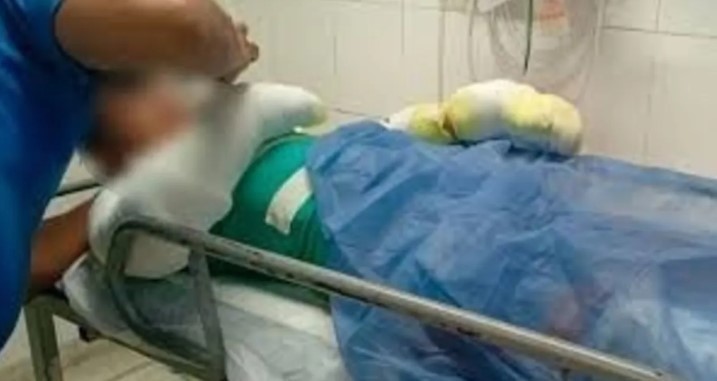 Córdoba: un adolescente sufrió quemaduras en el 60% de su cuerpo tras la explosión de su celular | Información General