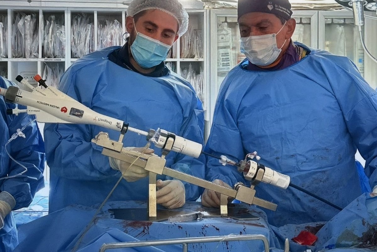 San Luis: realizaron el primer implante percutáneo con dispositivo “Dragón Fly” en pacientes de alto riesgo | Información General