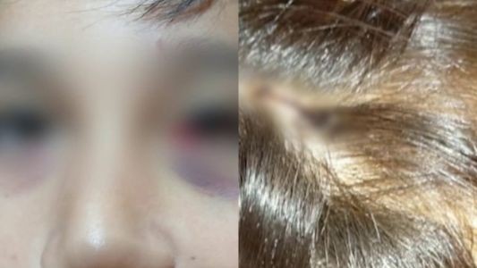 Mar del Plata: un alumno de 13 años fue apuñalado con una lapicera por un compañero en la escuela | Información General