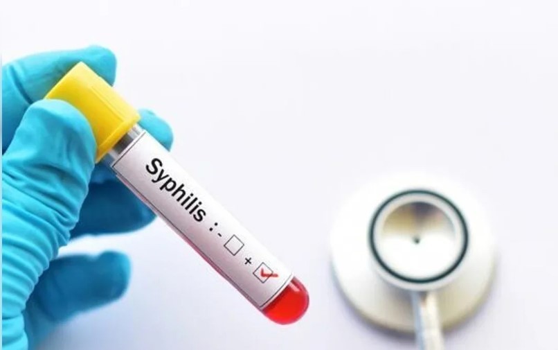 Preocupa el avance de la sífilis: fuerte suba de casos en el país | Información General