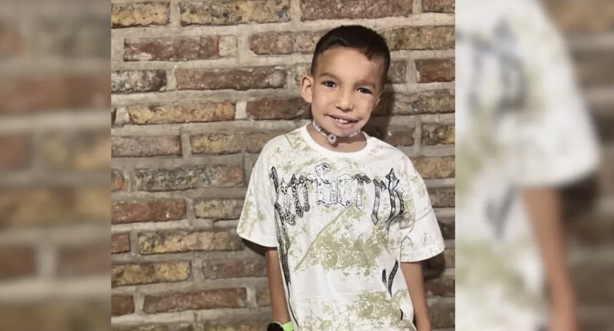 Bauti, un niño con Síndrome de Goldenhar, será operado nuevamente para favorecer el crecimiento de su mandíbula | Rosario y la región