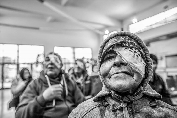 Salta: un equipo de oftalmólogos operó de cataratas a 450 personas sin recursos | Información General