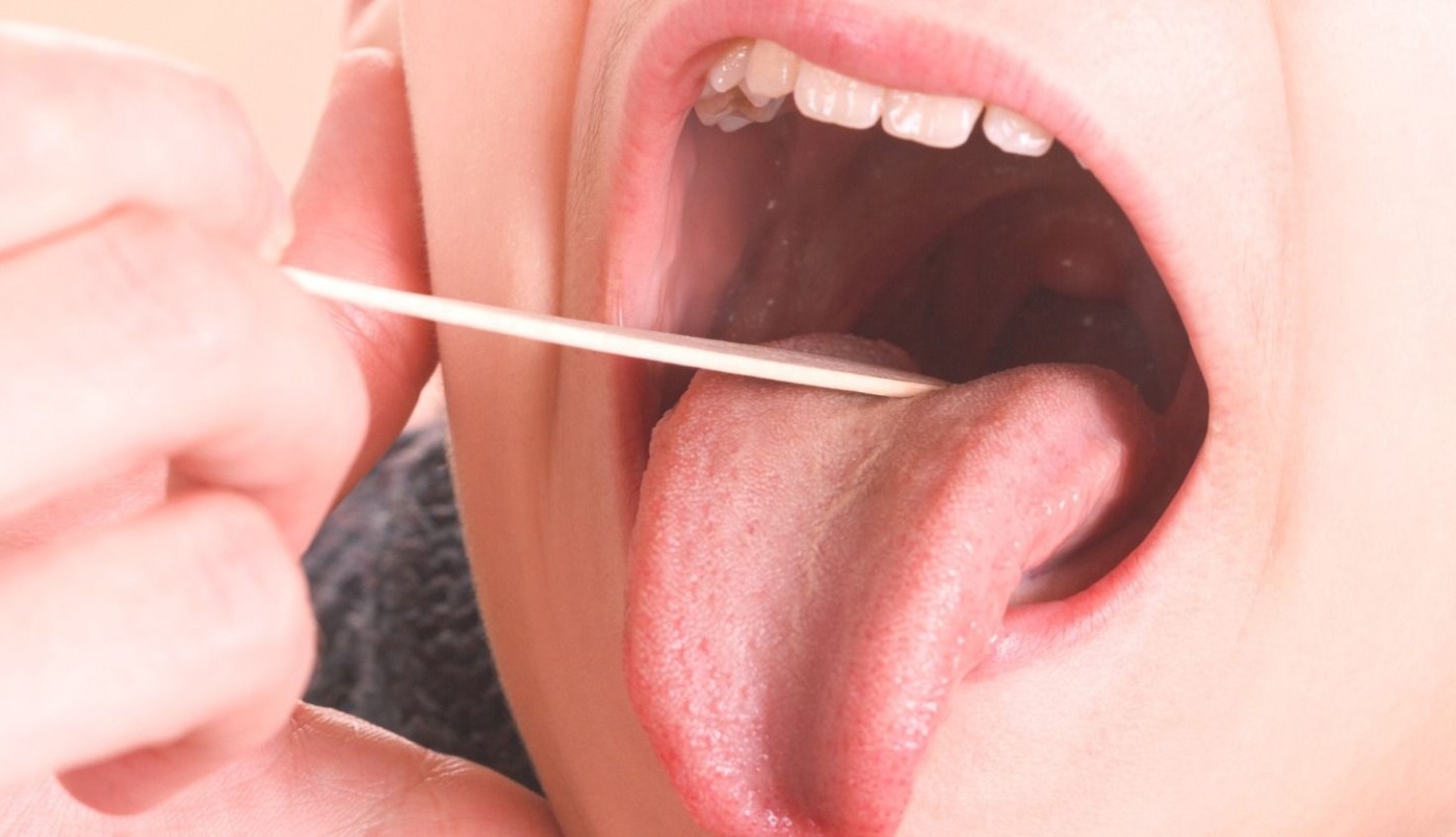 Ascienden a diez las muertes por estreptococo pyogenes | Información General