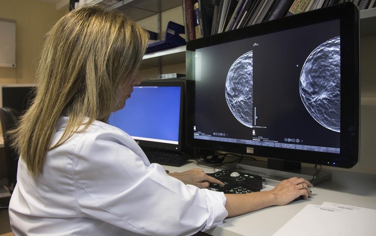 Lucha contra el cáncer de mama: realizan mamografías gratuitas para mayores de 50 años | Información General