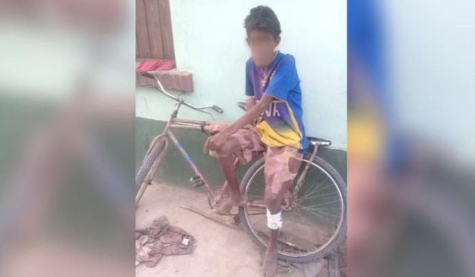 Murió un adolescente wichi de 14 años víctima de desnutrición | Información General