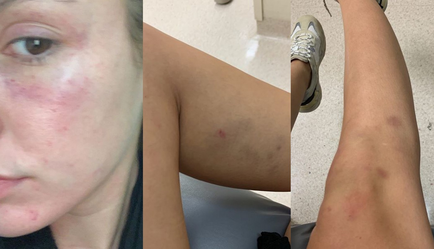 Impactante registro: una chica grabó el feroz ataque de su violento novio | Información General