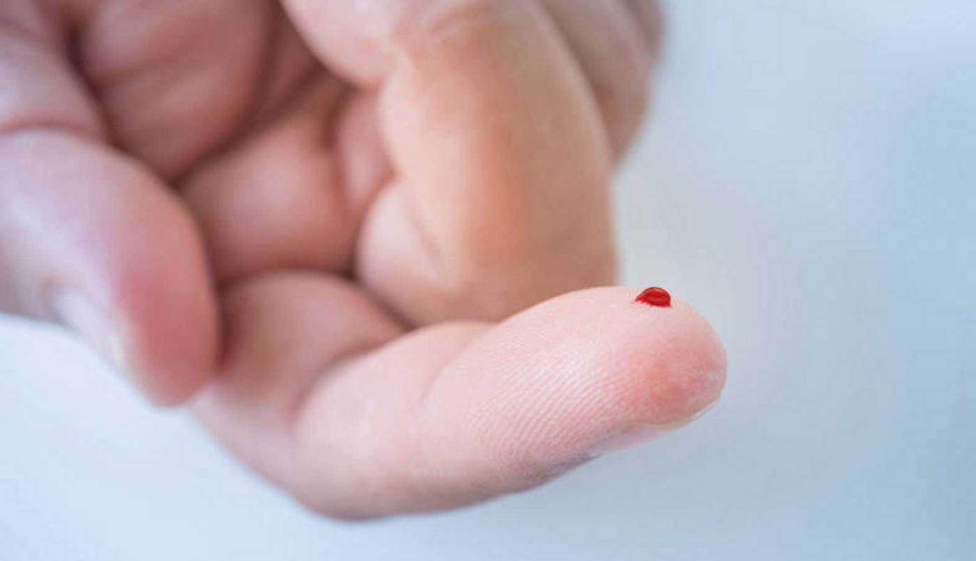 Realizan pruebas gratuitas de detección de VIH | Información General