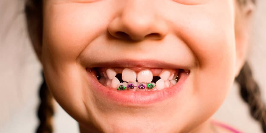 Anmat prohibió productos médicos indicados en tratamientos de ortodoncia | Información General