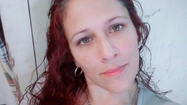 Continúa grave la mujer quemada por su pareja | Información General