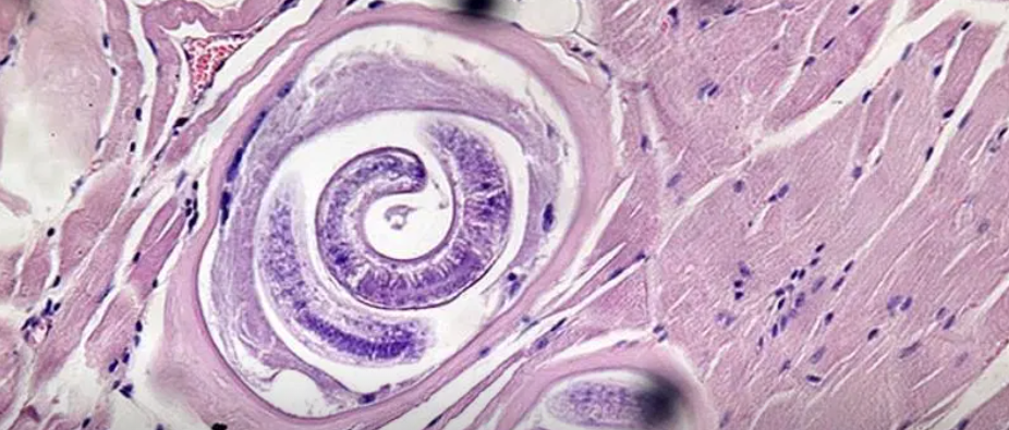 Triquinosis: más de 50 casos en Nelson y analizan una decena en Paiva | Información General