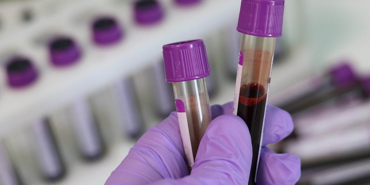 Cerca de 150 personas con COVID-19 mejoraron su salud al recibir plasma de pacientes recuperados | Información General