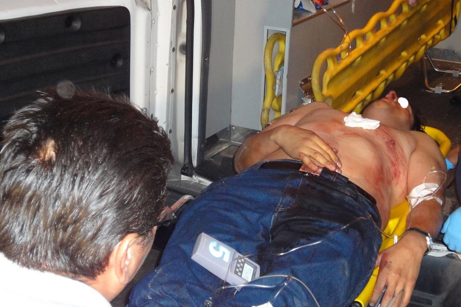 Su expareja lo apuñaló en el pecho y terminó internado | Información General