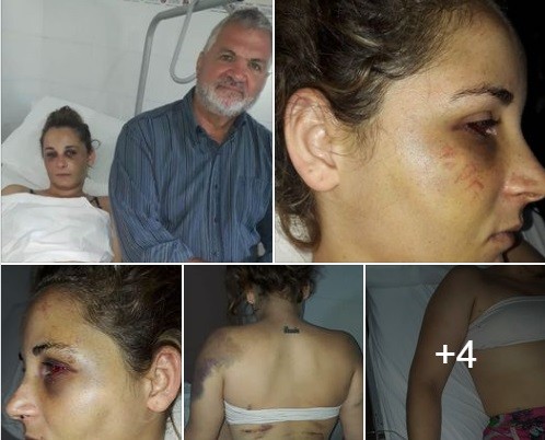 San Carlos Centro: Brutal golpiza de un hombre a su pareja | Información General