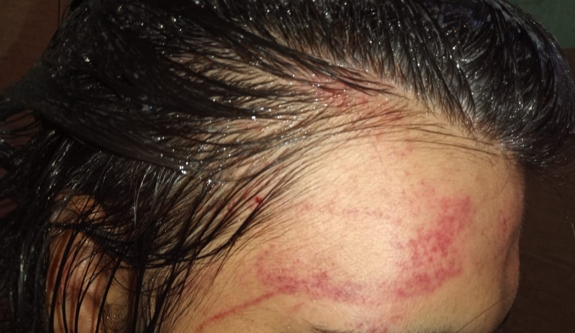 Golpiza de odio: atacaron en patota a trans de 16 años a la salida de una fiesta | Rosario y la región