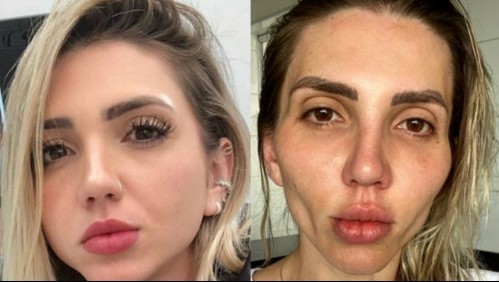 El drama de la tiktoker que se operó la cara: "Me convertí en una calavera" | Tecnología