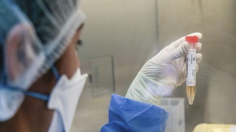 Expertos aconsejan completar las segundas dosis ante la variante Delta | Información General